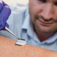 A health researcher swabs a patient's skin