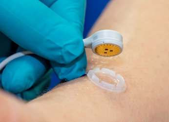 Close up of a skin sensor being placed on a patient's arm